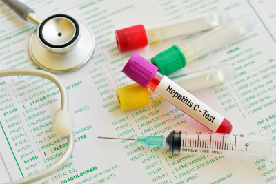 Blood sample for hepatitis C virus test